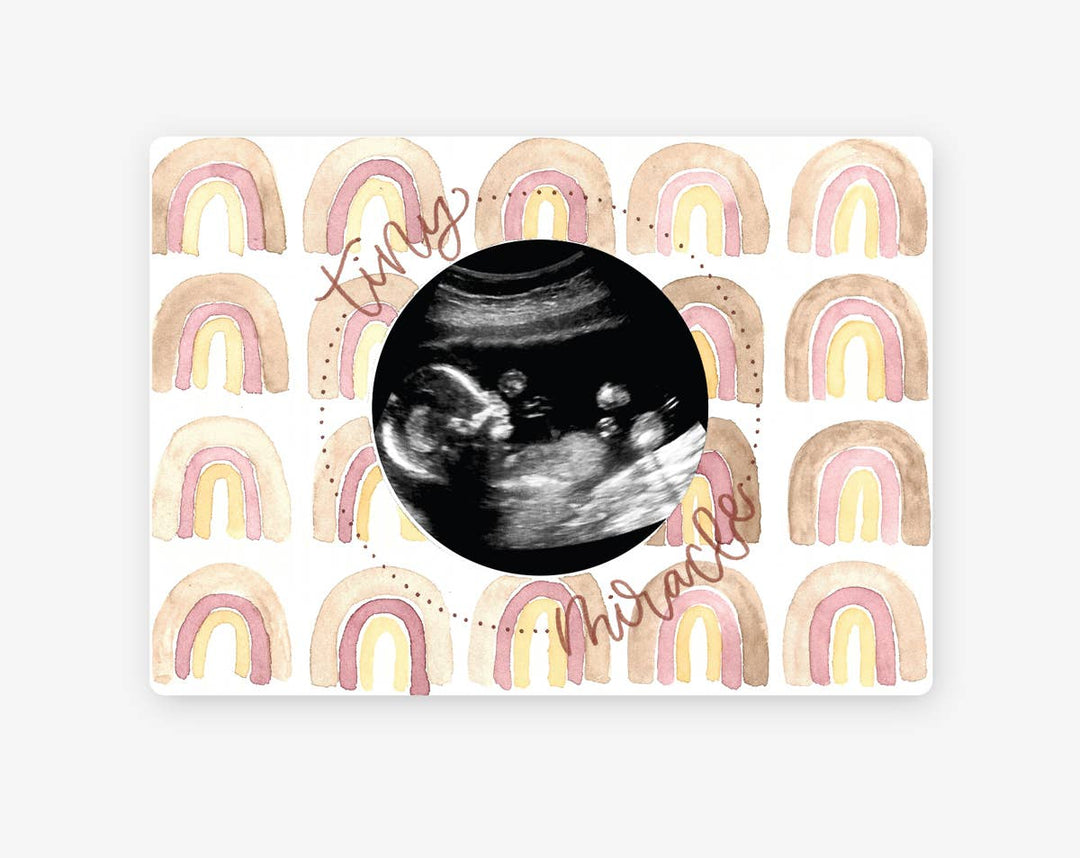 Magnetic Ultrasound Wooden Photo Frame